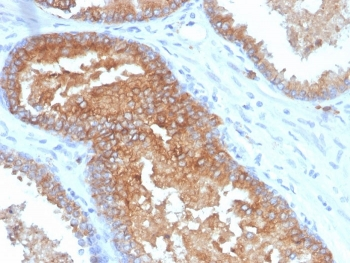CD38 Antibody