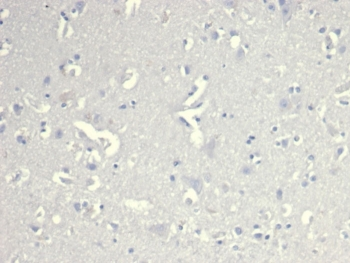 CD38 Antibody