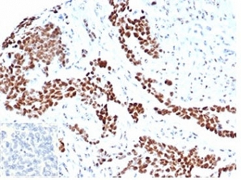 WT1 Antibody / Wilms Tumor 1