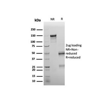 WT1 Antibody / Wilms Tumor 1
