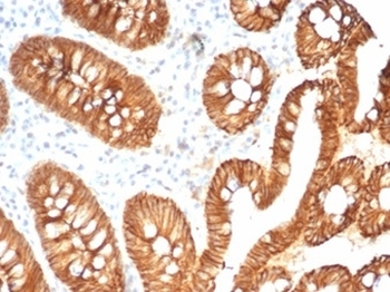 E-Cadherin Antibody / CDH1