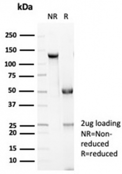 E-Cadherin Antibody / CDH1