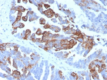 Cytokeratin 17 Antibody / CK17 / Keratin 17