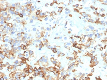 Cytokeratin 17 Antibody / CK17 / Keratin 17
