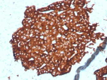 Synaptophysin Antibody