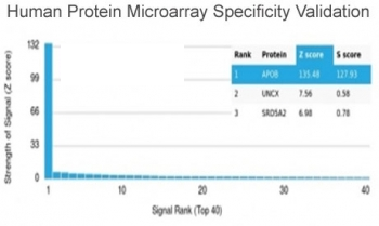 APOB Antibody / Apolipoprotein B
