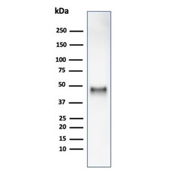 Cyclin E1 Antibody / CCNE1