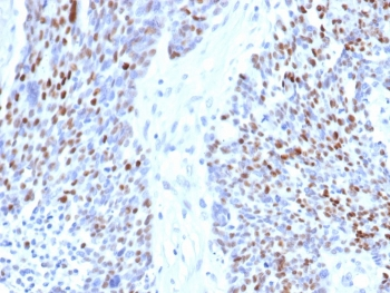 Cyclin E1 Antibody / CCNE1