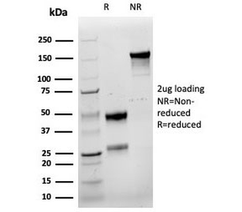 Cyclin E1 Antibody / CCNE1