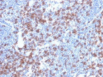 CD8A Antibody