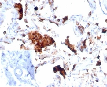 Napsin A Antibody