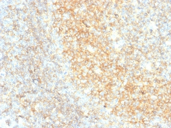 CD40 Antibody