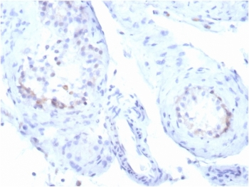 StAR Antibody / Steroidogenic acute regulatory protein