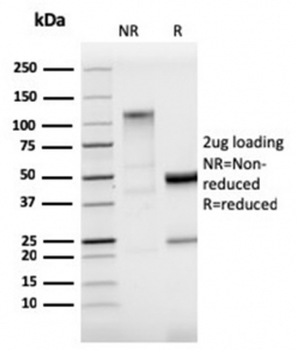 StAR Antibody / Steroidogenic acute regulatory protein