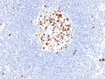 Topoisomerase II alpha Antibody / TOP2A