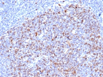 Topoisomerase II alpha Antibody / TOP2A