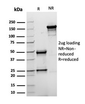 Topoisomerase II alpha Antibody / TOP2A