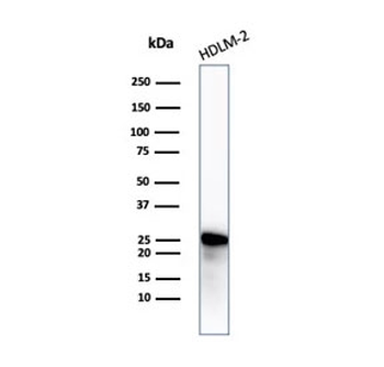 Bcl-2 Antibody