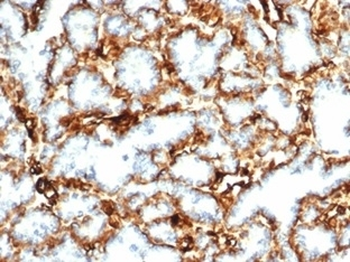 WT1 Antibody / Wilms Tumor 1