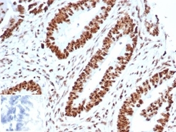 WT1 Antibody / Wilms Tumor 1