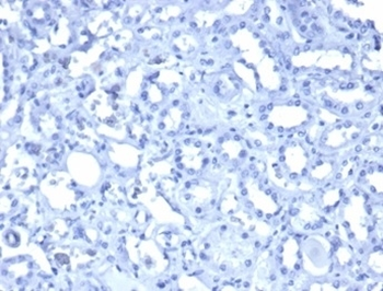 WT1 Antibody / Wilms Tumor 1