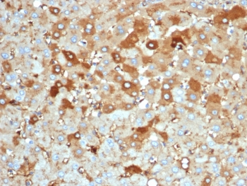 Albumin Antibody / ALB