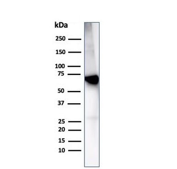 Albumin Antibody / ALB