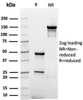 Albumin Antibody / ALB