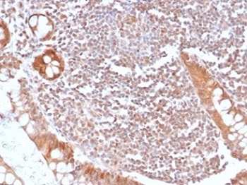 SMAD4 Antibody