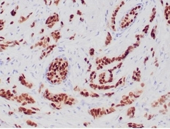 Progesterone Receptor Antibody