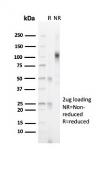 Progesterone Receptor Antibody