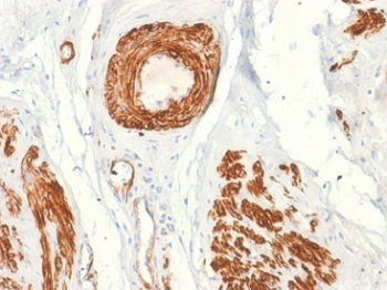Caldesmon Antibody / CALD1 / CAD (HMW)