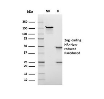 Nuclear Antigen Antibody