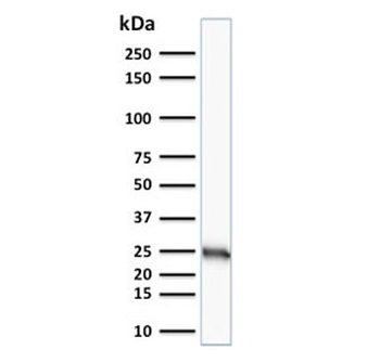 Bcl-2 Antibody
