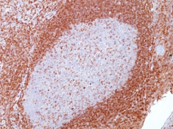 Bcl-2 Antibody
