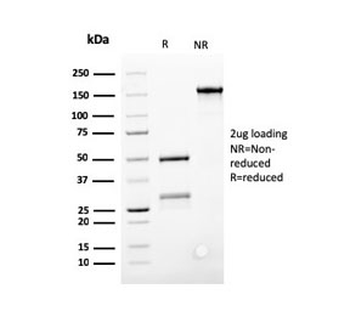 Bcl-2 Antibody