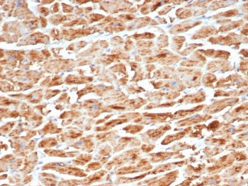 SDHB Antibody