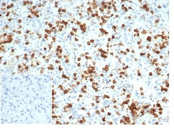 CD6 Antibody