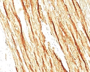 Smoothelin Antibody / SMSMO / SMTN