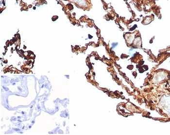 S100A4 Antibody