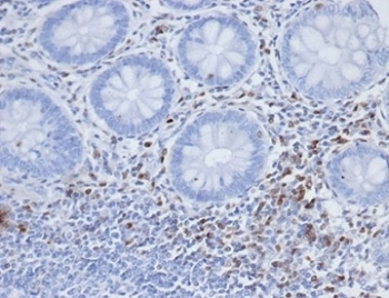 S100A4 Antibody