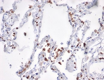 S100A4 Antibody