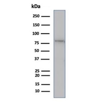 MLH1 Antibody / MutL Homolog 1