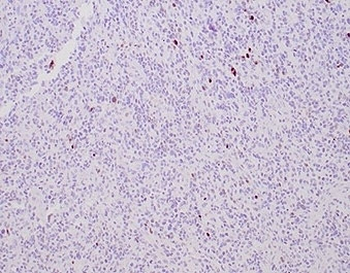 MGMT Antibody