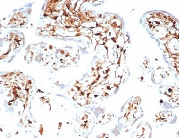 S100A4 Antibody
