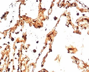 S100A4 Antibody