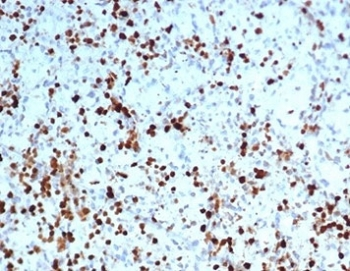 S100A4 Antibody