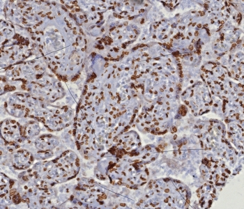dsDNA Antibody / Double Stranded DNA
