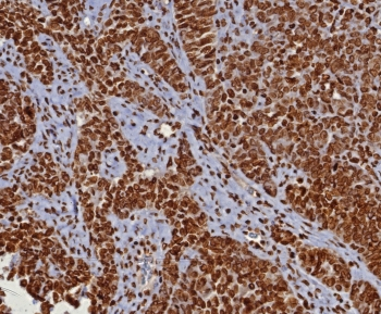 dsDNA Antibody / Double Stranded DNA