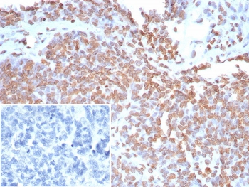 Double Stranded DNA Antibody / dsDNA